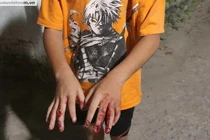 Chủ tịch nước yêu cầu làm rõ vụ cha đánh con nát tay