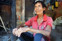 Người rừng Hồ Văn Lang mắc bệnh ung thư gan 