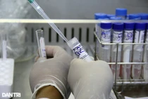 Phú Yên: “Chúng tôi mua kit Việt Á mức thấp trong dải giá Bộ Y tế đưa ra“