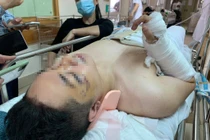 Vụ thủng sàn chung cư Meco Complex: Nạn nhân bị gãy tay, cột sống