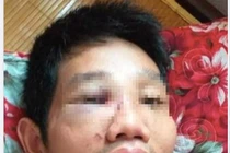 Mâu thuẫn tại chốt kiểm dịch, một cán bộ bị đánh nhập viện