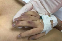 Kết luận nguyên nhân cháu bé 6 tuổi bị bố đánh tử vong ở Hà Nội