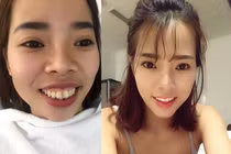 Ngỡ ngàng nhan sắc trước khi “dao kéo” của 5 gái xinh Việt