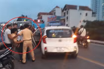 Sức khỏe Trung tá CSGT bị xe máy kẹp 3 tông giờ thế nào?