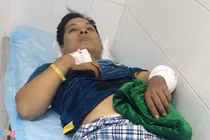  Thực hư vụ tài xế bị chém nghi mâu thuẫn ở BOT Cai Lậy