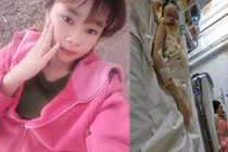 Vì sao thiếu nữ 17 tuổi bị tạt axit kinh hoàng giữa TP Cần Thơ? 