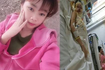 Vì sao thiếu nữ 17 tuổi bị tạt axit kinh hoàng giữa TP Cần Thơ? 