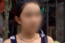 Công an khẩn trương truy tìm kẻ rạch đùi, đâm kim tiêm phụ nữ