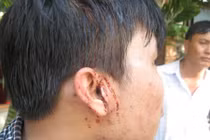 Vụ phóng viên bị hành hung: Nạn nhân bị ám ảnh kinh hoàng