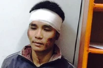 Hung thủ cướp tiệm vàng từng là nhân viên trật tự đô thị