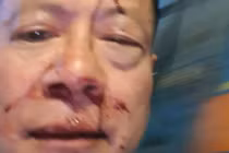 Việt kiều Đức với thương tích trên người.