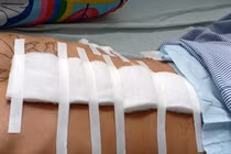 Hình minh hoạ. Ảnh: Internet