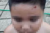 Những vết đạn bắn trên người các nạn nhân 