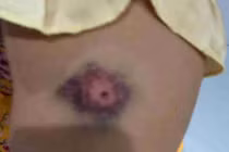 Con anh Tý với vết thương trên đầu. 