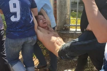 Nghi can trộm mai Tết chém trung uý Công an thủng bụng lòi ruột ra ngoài bị bắt.