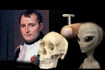 Nóng: Người ngoài hành tinh "cả gan" cấy vi mạch vào hộp sọ Napoleon? 