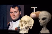 Nóng: Người ngoài hành tinh "cả gan" cấy vi mạch vào hộp sọ Napoleon? 