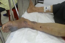 Rắn lạ cắn người ở Bà Rịa Vũng Tàu: Là "mìn sống" của Việt Nam