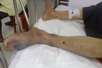 Rắn lạ cắn người ở Bà Rịa Vũng Tàu: Là "mìn sống" của Việt Nam