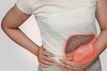 3 dấu hiệu khi đi vệ sinh chứng tỏ gan đang bị tổn thương nặng