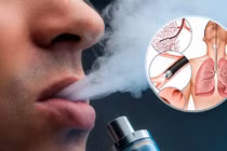 Học sinh sử dụng thuốc lá điện tử tràn lan nguy hiểm cỡ nào?