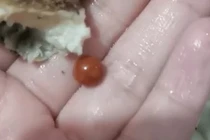 Ăn ốc cắn phải vật lạ, cô gái sướng điên vì... sắp phát tài