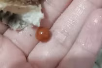 Ăn ốc cắn phải vật lạ, cô gái sướng điên vì... sắp phát tài