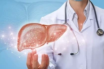 Nóng: Tái tạo và sản xuất gan ghép tạng trong phòng thí nghiệm