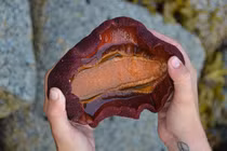 Bất ngờ “khối thịt lang thang” chứa khoáng chất hiếm gặp trong răng