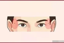 10 nốt ruồi may mắn nhất, nhìn thoáng qua là có thể biết được