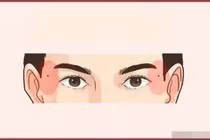 10 nốt ruồi may mắn nhất, nhìn thoáng qua là có thể biết được