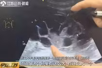 Nữ sinh 20 tuổi liều mình đi 'hiến' trứng để mua iphone 12 