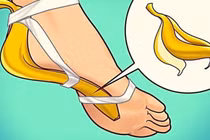 Chà vỏ chuối lên bàn chân bạn sẽ bất ngờ khi điều này xảy ra