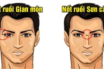 7 nốt ruồi chặn đứng tài lộc, có 2/7 cả đời điêu đứng