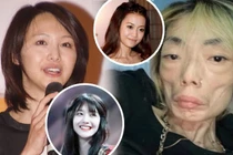 Hai mỹ nhân Hoa ngữ tự hủy hoại nhan sắc