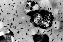 Giải mã được bí ẩn 700 năm về nguồn gốc Cái chết Đen 