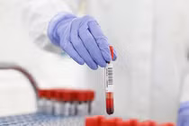 Ngày 26/12: Có 15.218 ca COVID-19