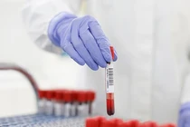 Ngày 26/12: Có 15.218 ca COVID-19