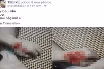 Thanh niên xăm trổ đăng ảnh cắt nát tay vì thất tình