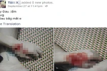 Thanh niên xăm trổ đăng ảnh cắt nát tay vì thất tình