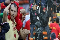 Bức xúc fan Việt Nam bị CĐV Malaysia đánh đập 