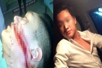 Chàng trai Hải Phòng bị rạch mặt giữa đường lên mạng cảnh báo