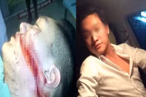 Chàng trai Hải Phòng bị rạch mặt giữa đường lên mạng cảnh báo