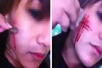 Xôn xao thiếu nữ dùng dao lam rạch nát mặt