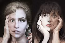 Sốt mạng bộ ảnh ác mộng về nhan sắc nhân tạo