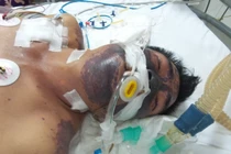 Mất Tết vì... bát tiết canh