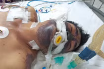 Mất Tết vì... bát tiết canh