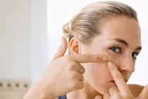 Mặt bị 'tàn phá' vì dùng kháng sinh trị mụn sai cách