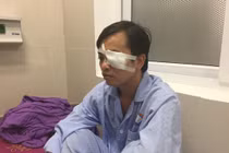 Điều tra vụ tấn công bác sĩ gây chấn thương sọ não, rách giác mạc