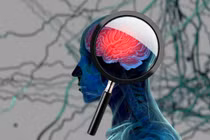 Ngủ sâu giấc giúp não thải các chất độc ra ngoài